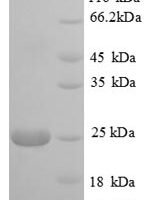 Bovine Polymeric immunoglobulin receptor (PIGR), partial Recombinant Protein - BioCrest Sci