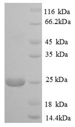 Bovine Polymeric immunoglobulin receptor (PIGR), partial Recombinant Protein, Bos taurus (Bovine), E.coli, N-terminal 6xHis-tagged, 26.0 kDa, purity >≥ 90% as determined by SDS-PAGE.