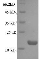Human Protein prune homolog (PRUNE) Recombinant Protein - BioCrest Sci