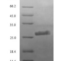 Human Complement C3 (C3), partial Recombinant Protein - BioCrest Sci