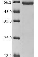 Human Desmoglein-3 (DSG3), partial Recombinant Protein, N-10His/C-Myc - BioCrest Sci