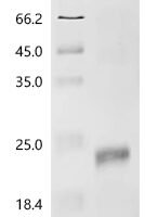 Mouse Inhibin beta E chain (Inhbe) Recombinant Protein, C-His - BioCrest Sci