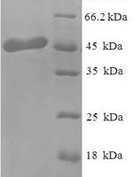 Human Mimecan (OGN) Recombinant Protein, N-His, aa 21–298, E.coli - BioCrest Sci