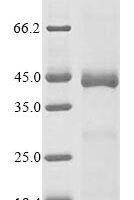 Mouse Serine protease HTRA1 (Htra1), partial Recombinant Protein - BioCrest Sci