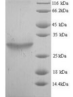 Escherichia coli 1-acyl-sn-glycerol-3-phosphate acyltransferase (plsC) Recombinant Protein, N-His - BioCrest Sci
