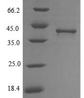 Bartonella henselae Lipoyl synthase (lipA) Recombinant Protein, N-His - BioCrest Sci