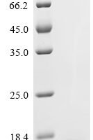 Human Kidney-associated antigen 1 (KAAG1) Recombinant Protein - BioCrest Sci