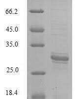 Escherichia coli tRNA threonylcarbamoyladenosine biosynthesis protein TsaE (tsaE) Recombinant Protein, C-hFc1 - BioCrest Sci