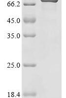 Mouse Sarcosine dehydrogenase, mitochondrial (Sardh), partial Recombinant Protein, C-His - BioCrest Sci