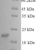 Dog Caveolin-1 (CAV1) Recombinant Protein - BioCrest Sci