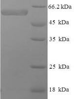Human SWI/SNF-related matrix-associated actin-dependent regulator of chromatin subfamily B member 1 (SMARCB1), partial Recombinant Protein, N-His-SUMO - BioCrest Sci