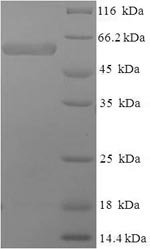 Human SWI/SNF-related matrix-associated actin-dependent regulator of chromatin subfamily B member 1 (SMARCB1), partial Recombinant Protein, N-His-SUMO, Homo sapiens (Human), E.coli, N-terminal 6xHis-SUMO-tagged, 59.0 kDa, purity >≥ 90% as determined by SDS-PAGE.