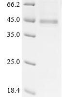 Human CAD protein (CAD), partial Recombinant Protein - BioCrest Sci