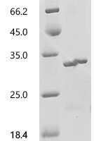 Human Neuronal acetylcholine receptor subunit alpha-3 (CHRNA3), partial Recombinant Protein, C-10His, aa 32–240, E.coli - BioCrest Sci
