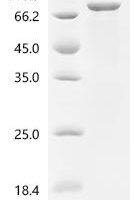 Human Kynurenine/alpha-aminoadipate aminotransferase, mitochondrial (AADAT) Recombinant Protein, N-MBP/C-His - BioCrest Sci