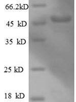 Human Actin-related protein 2/3 complex subunit 3 (ARPC3), partial Recombinant Protein - BioCrest Sci