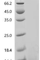 Mouse Resistin (Retn) Recombinant Protein, N-His - BioCrest Sci