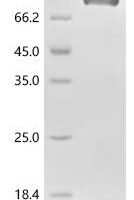 Human RecQ-like DNA helicase BLM (BLM) (K24A),partial Recombinant Protein - BioCrest Sci
