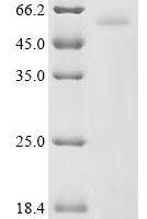 Human Histidine decarboxylase (HDC), partial Recombinant Protein, C-His, aa 2–477, Yeast - BioCrest Sci