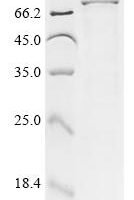 Mouse Small conductance calcium-activated potassium channel protein 2 (Kcnn2), partial Recombinant Protein - BioCrest Sci
