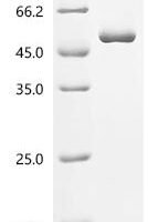 Human Uncharacterized protein C8orf76 (C8orf76) Recombinant Protein - BioCrest Sci