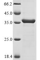 Klebsiella pneumoniae OmpK36 (OmpK36) Recombinant Protein, Tag-Free - BioCrest Sci