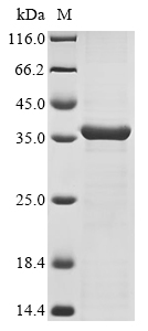 Klebsiella pneumoniae OmpK36 (OmpK36) Recombinant Protein, Tag-Free, Klebsiella pneumoniae, E.coli, Tag-Free, 38.9 kDa, purity >≥ 85% as determined by SDS-PAGE.
