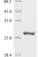 Streptococcus pneumoniae serotype 4 ribosomal protein S12 (rpsL) Recombinant Protein - BioCrest Sci