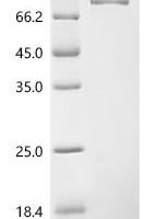 Human N-acetylated-alpha-linked acidic dipeptidase 2 (NAALAD2), partial,Biotinylated Recombinant Protein - BioCrest Sci