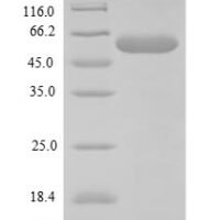 Mouse F-box/WD repeat-containing protein 10 (Fbxw10), partial Recombinant Protein - BioCrest Sci