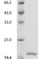 Human Alpha-synuclein (SNCA), partial Recombinant Protein, Tag-Free - BioCrest Sci