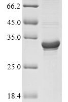 Hypoderma lineatum Collagenase (C200S) Recombinant Protein - BioCrest Sci