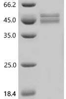 Mouse Glial fibrillary acidic protein (Gfap) Recombinant Protein, C-His, aa 1–430, Baculovirus - BioCrest Sci
