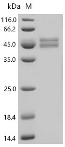 Mouse Glial fibrillary acidic protein (Gfap) Recombinant Protein, C-His, aa 1–430, Baculovirus, Mus musculus (Mouse), Baculovirus, C-terminal 6xHis-tagged, 53.3 kDa, purity >≥ 90% as determined by SDS-PAGE.