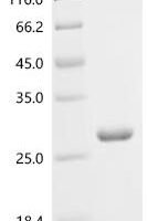 Human Prostaglandin-H2 D-isomerase (PTGDS)(176-185:TIVFLPQTDK→Missing) Recombinant Protein - BioCrest Sci