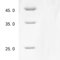 Human Mitochondrial antiviral-signaling protein (MAVS), partial Recombinant Protein, N-His-SUMO - BioCrest Sci