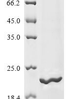 Human Sodium channel protein type 1 subunit alpha (SCN1A), partial Recombinant Protein, N-10His/C-Myc - BioCrest Sci