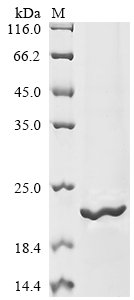 Human Sodium channel protein type 1 subunit alpha (SCN1A), partial Recombinant Protein, N-10His/C-Myc, Homo sapiens (Human), Baculovirus, N-terminal 10xHis-tagged and C-terminal Myc-tagged, 18.3 kDa, purity >≥ 85% as determined by SDS-PAGE.