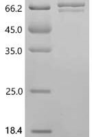 Mouse Vitamin K-dependent protein S (Pros1), partial Recombinant Protein - BioCrest Sci