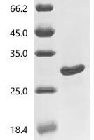 Human GTPase KRas (KRAS) (G12C), partial Recombinant Protein, C-His - BioCrest Sci