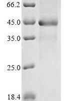 Mouse Aldo-keto reductase family 1 member C13 (Akr1c13) Recombinant Protein - BioCrest Sci