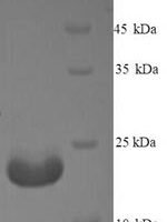 Mycobacterium tuberculosis Immunogenic protein MPT64 (mpt64) Recombinant Protein, N-His, aa 24–228, Yeast - BioCrest Sci