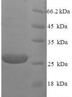 Human Retinoschisin (RS1) Recombinant Protein, N-His - BioCrest Sci