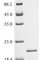 Rat Zymogen granule membrane protein 16 (Zg16) Recombinant Protein, N-His, aa 17–167, E.coli - BioCrest Sci