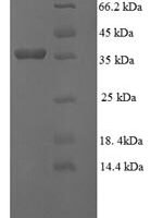 Human Gamma-glutamylcyclotransferase (GGCT) Recombinant Protein - BioCrest Sci