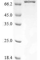 Human Non-POU domain-containing octamer-binding protein (NONO) Recombinant Protein, N-His-SUMO - BioCrest Sci