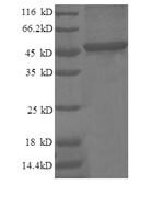 Human Cyclin-dependent kinase inhibitor 1 (CDKN1A) Recombinant Protein - BioCrest Sci
