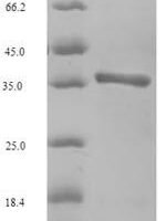 Horse Major allergen Equ c 1 Recombinant Protein - BioCrest Sci