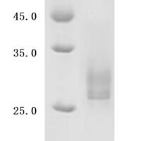 Human Disintegrin and metalloproteinase domain-containing protein 9 (ADAM9), Partial Recombinant Protein - BioCrest Sci