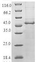 Human Charged multivesicular body protein 1b (CHMP1B) Recombinant Protein - BioCrest Sci